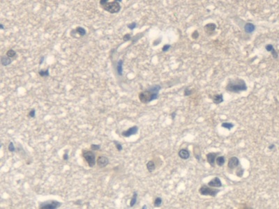 Polyclonal Antibody to Isoleucyl tRNA Synthetase (IARS)