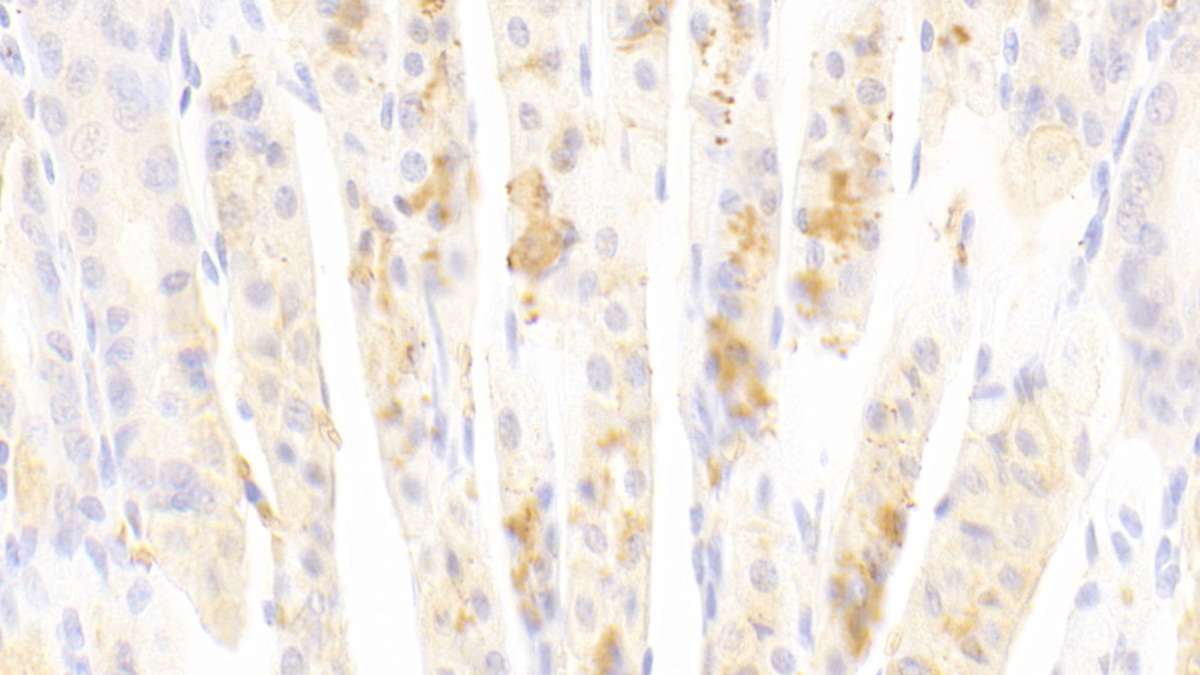 Polyclonal Antibody to Methionyl tRNA Synthetase (MARS)