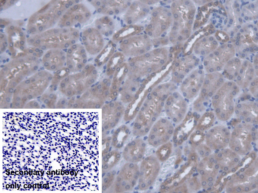 Polyclonal Antibody to Valyl tRNA Synthetase (VARS)