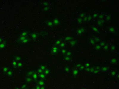 Polyclonal Antibody to X-Ray Repair Cross Complementing 5 (XRCC5)