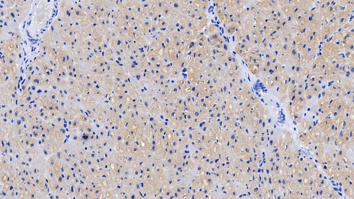 Polyclonal Antibody to Myosin Binding Protein C, Cardiac (MYBPC3)