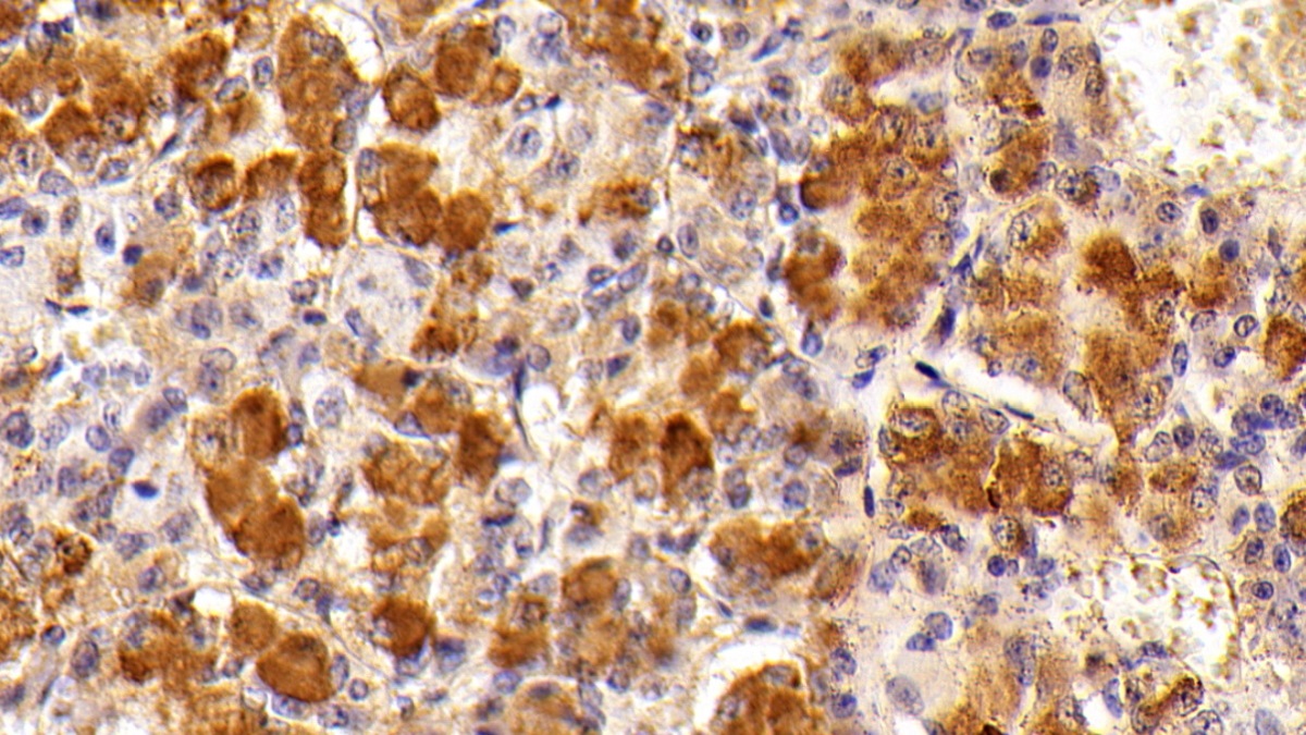 Polyclonal Antibody to Follicle Stimulating Hormone Beta (FSHb)