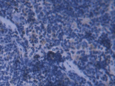 Polyclonal Antibody to Ferritin, Light Polypeptide (FTL)