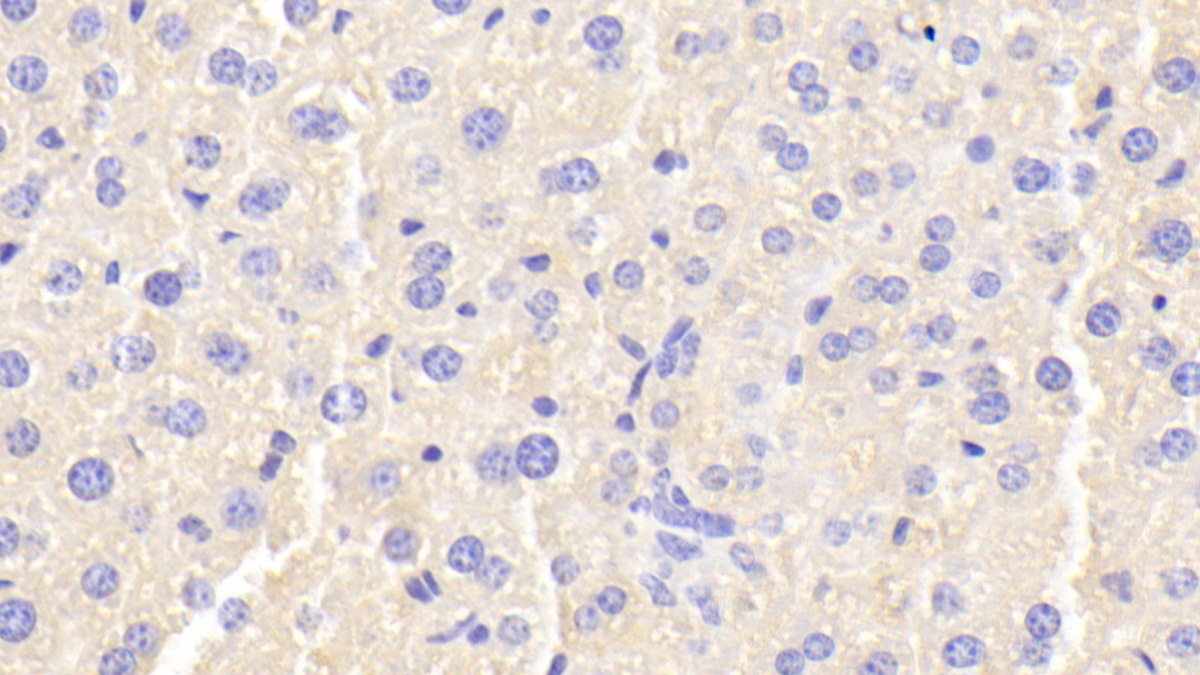 Polyclonal Antibody to Ferritin, Heavy Polypeptide (FTH)