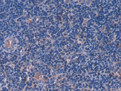 Polyclonal Antibody to Fibrinogen Like Protein 1 (FGL1)