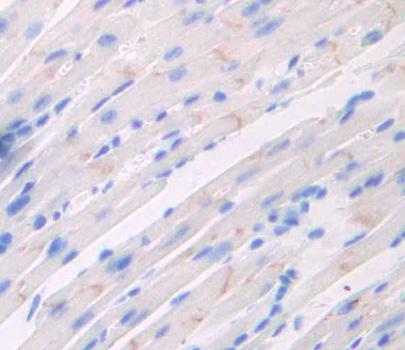 Polyclonal Antibody to Triadin (TRDN)