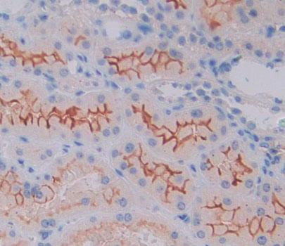 Polyclonal Antibody to Calcium/Calmodulin Dependent Protein Kinase I (CAMK1)