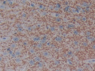 Polyclonal Antibody to Natriuretic Peptide Receptor 3 (NPR3)