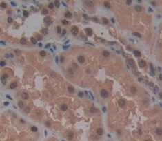 Polyclonal Antibody to Heat Shock 70kDa Protein 2 (HSPA2)