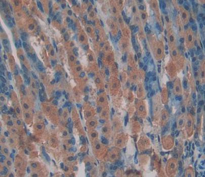 Polyclonal Antibody to Heat Shock 70kDa Protein 8 (HSPA8)