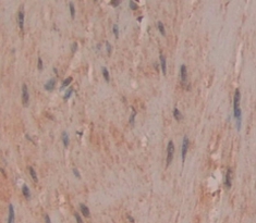 Polyclonal Antibody to Carbonic Anhydrase III, Muscle Specific (CA3)