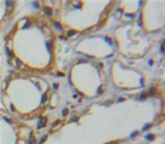 Polyclonal Antibody to Carbonic Anhydrase IV (CA4)