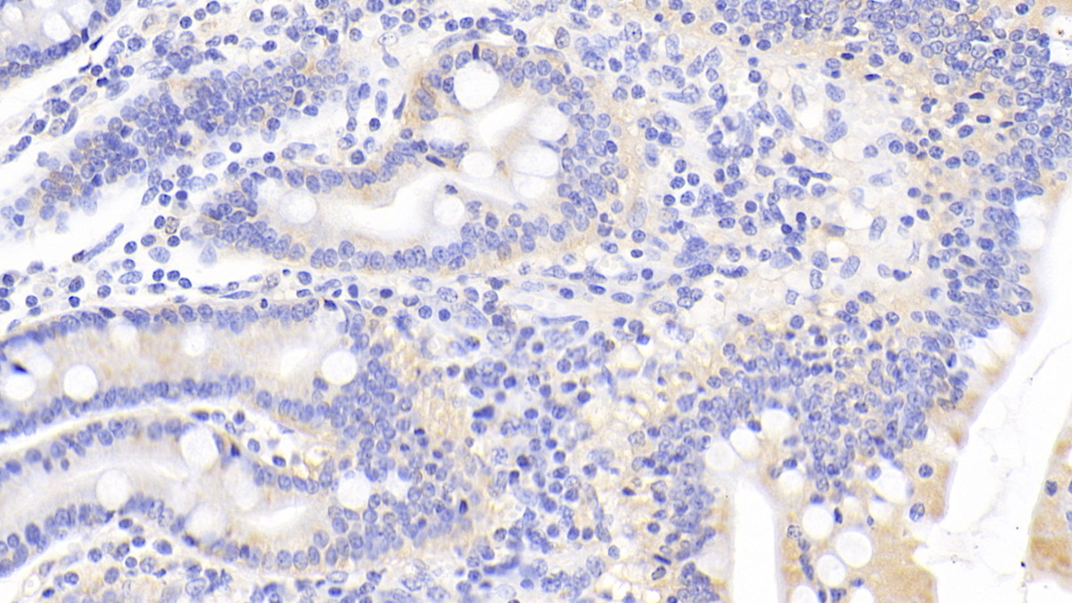 Polyclonal Antibody to Acid Phosphatase 6, Lysophosphatidic (ACP6)