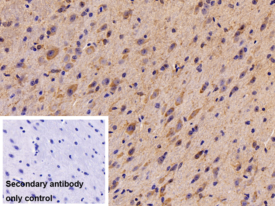 Polyclonal Antibody to Low Density Lipoprotein Receptor Related Protein Associated Protein 1 (LRPAP1)