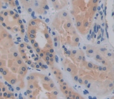 Polyclonal Antibody to Hedgehog Homolog, Indian (IHH)