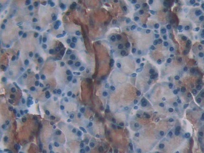 Polyclonal Antibody to Urocortin 3 (UCN3)