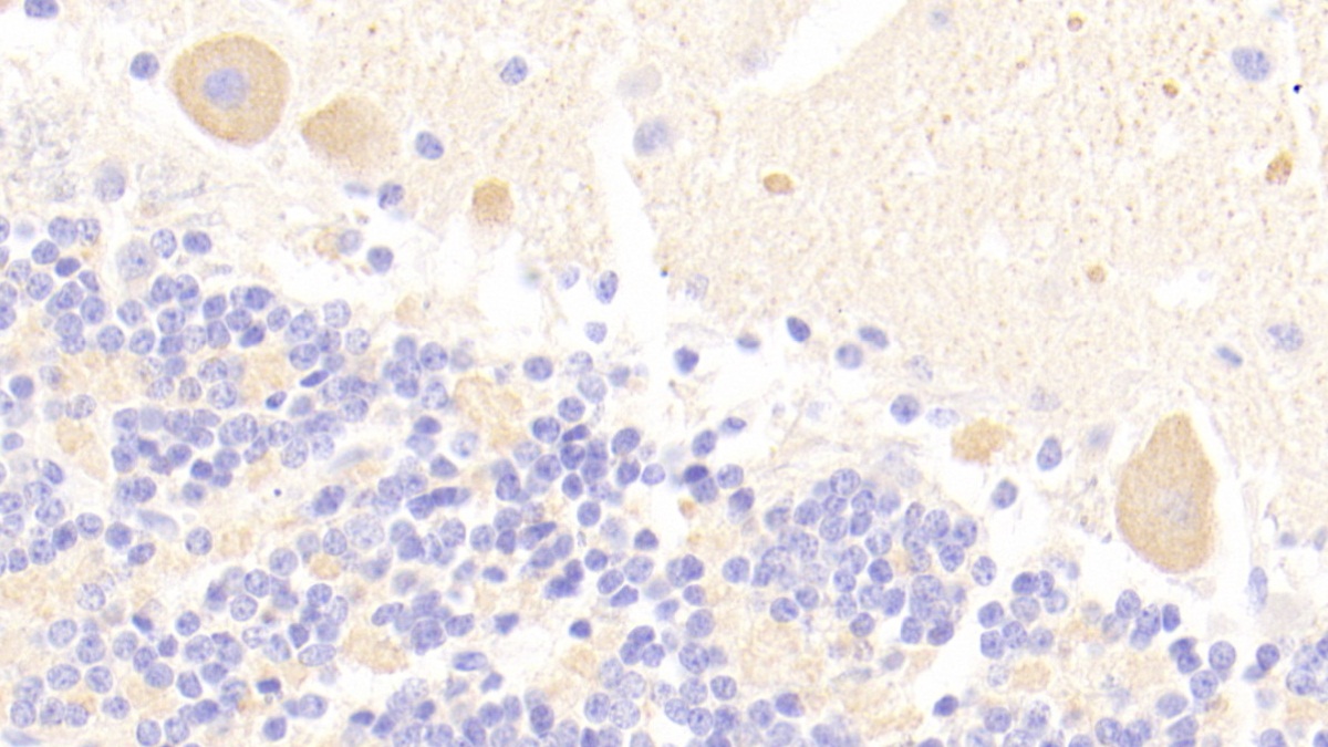 Polyclonal Antibody to Cholinergic Receptor, Nicotinic, Alpha 3 (CHRNa3)