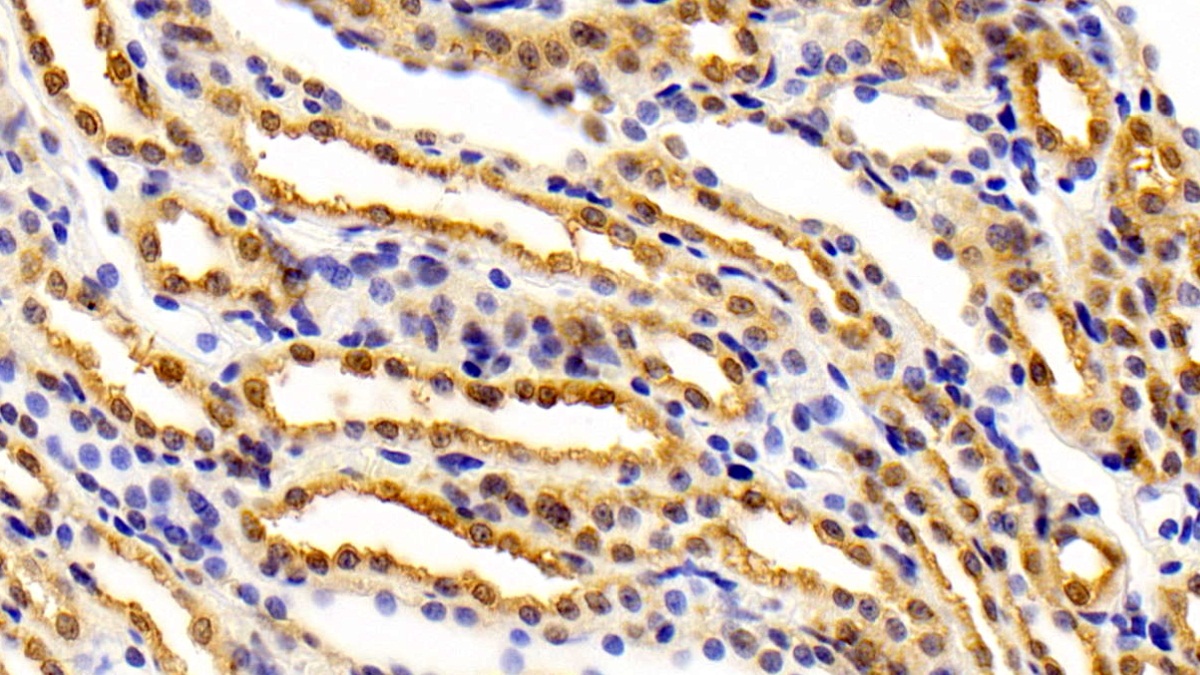 Polyclonal Antibody to Fasciculation And Elongation Protein Zeta 2 (FEz2)