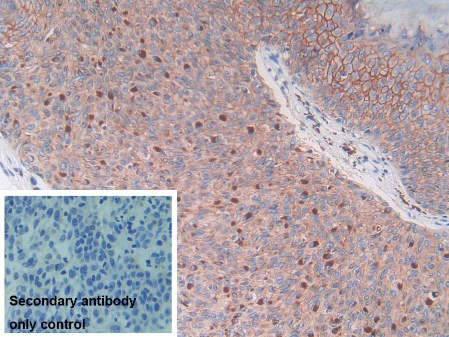 Polyclonal Antibody to S100 Calcium Binding Protein A14 (S100A14)