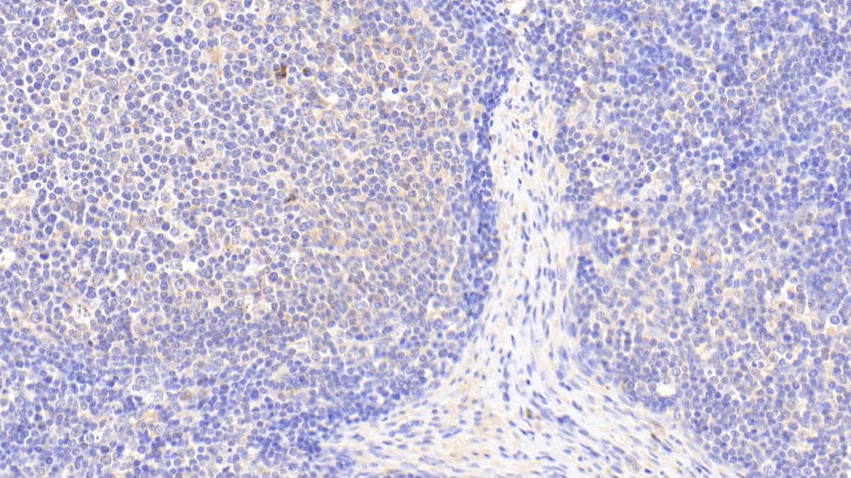 Polyclonal Antibody to S100 Calcium Binding Protein Z (S100Z)