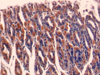 Polyclonal Antibody to Exoribonuclease 1 (ERI1)