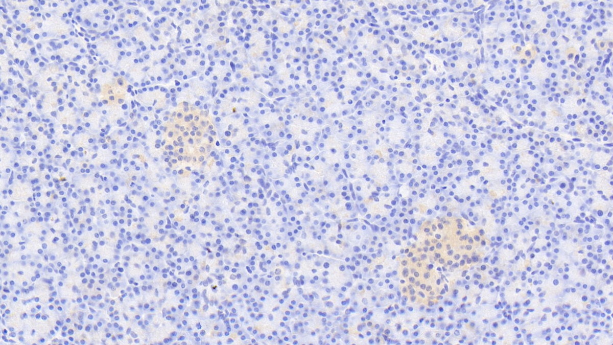 Polyclonal Antibody to 5'-3'Exoribonuclease 1 (XRN1)