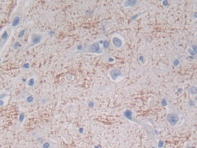 Polyclonal Antibody to Interferon Epsilon (IFNe)