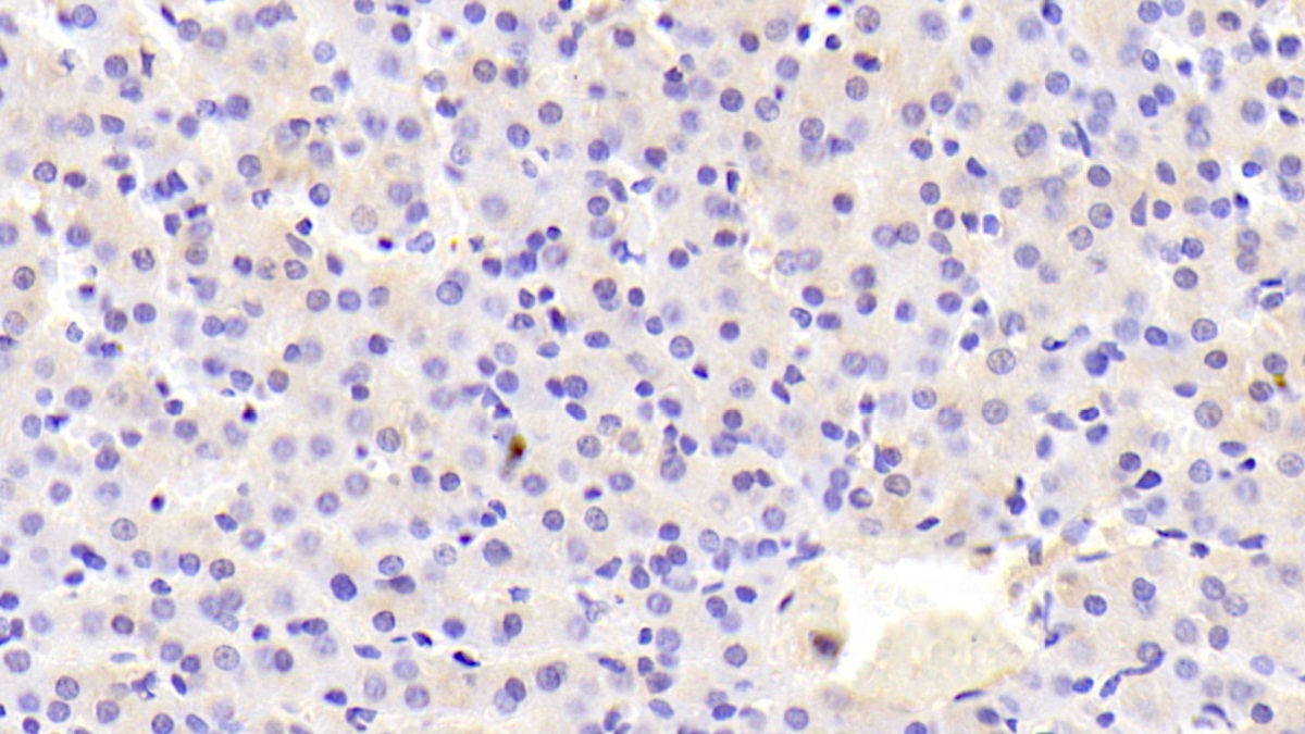 Polyclonal Antibody to Paraoxonase 2 (PON2)