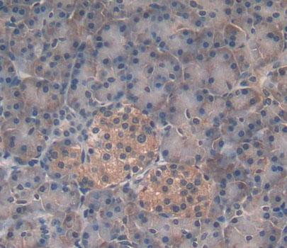 Polyclonal Antibody to Mannosyl Oligosaccharide Glucosidase (MOGS)