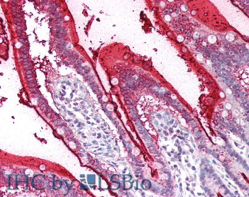 Polyclonal Antibody to Sucrase Isomaltase (SI)