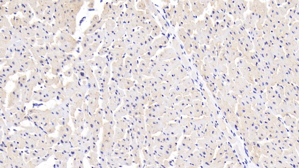 Polyclonal Antibody to Sjogren Syndrome Antigen A1 (SSA1)