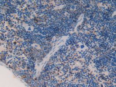 Polyclonal Antibody to Complement Component 1, Q Subcomponent A (C1qA)