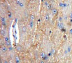 Polyclonal Antibody to Complement Component 1, Q Subcomponent A (C1qA)