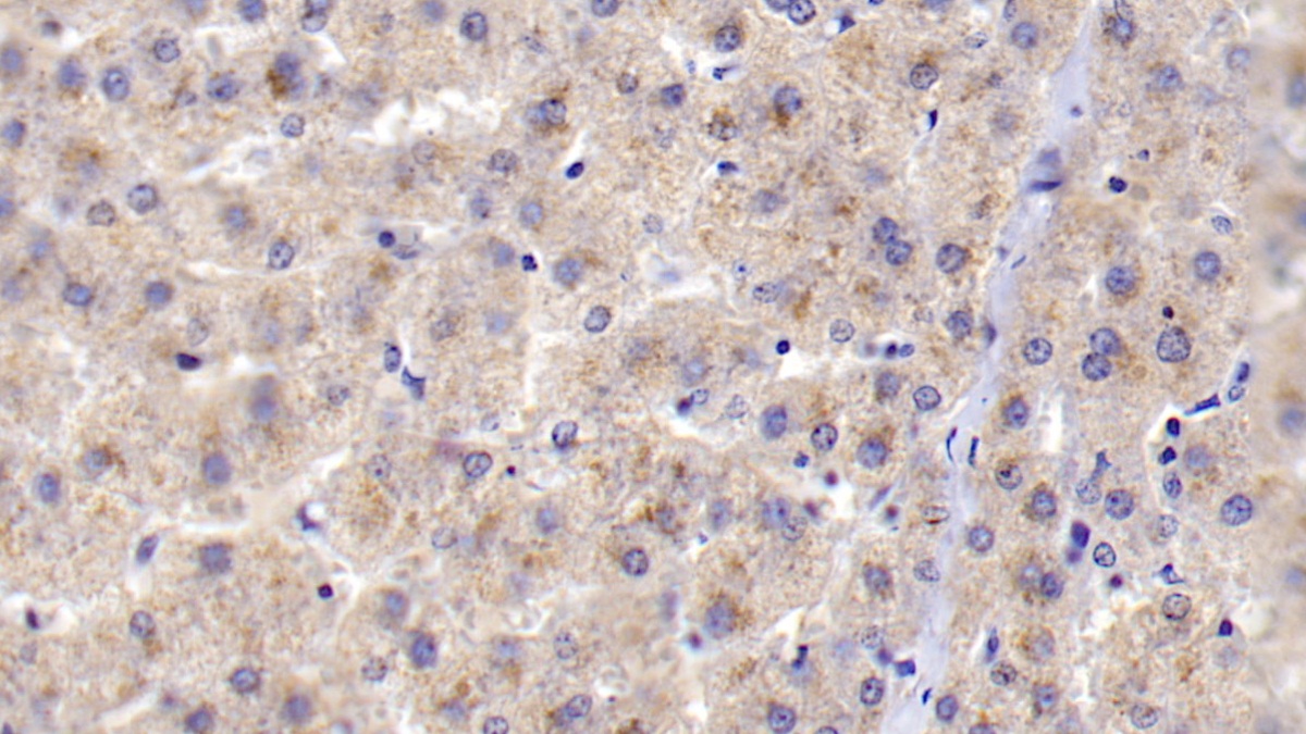 Polyclonal Antibody to Complement Component 1, Q Subcomponent B (C1qB)