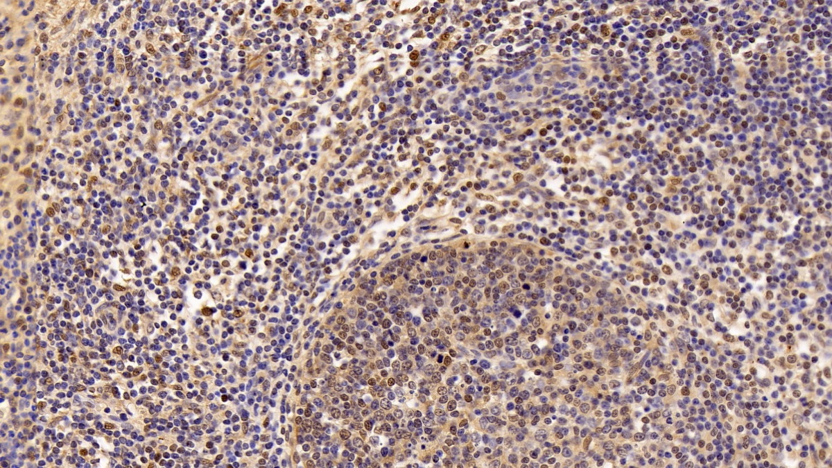 Polyclonal Antibody to Prothymosin Alpha (PTMa)