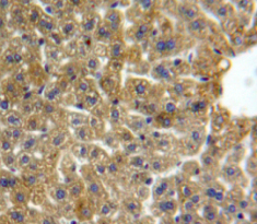 Polyclonal Antibody to Lipase A, Lysosomal Acid (LIPA)