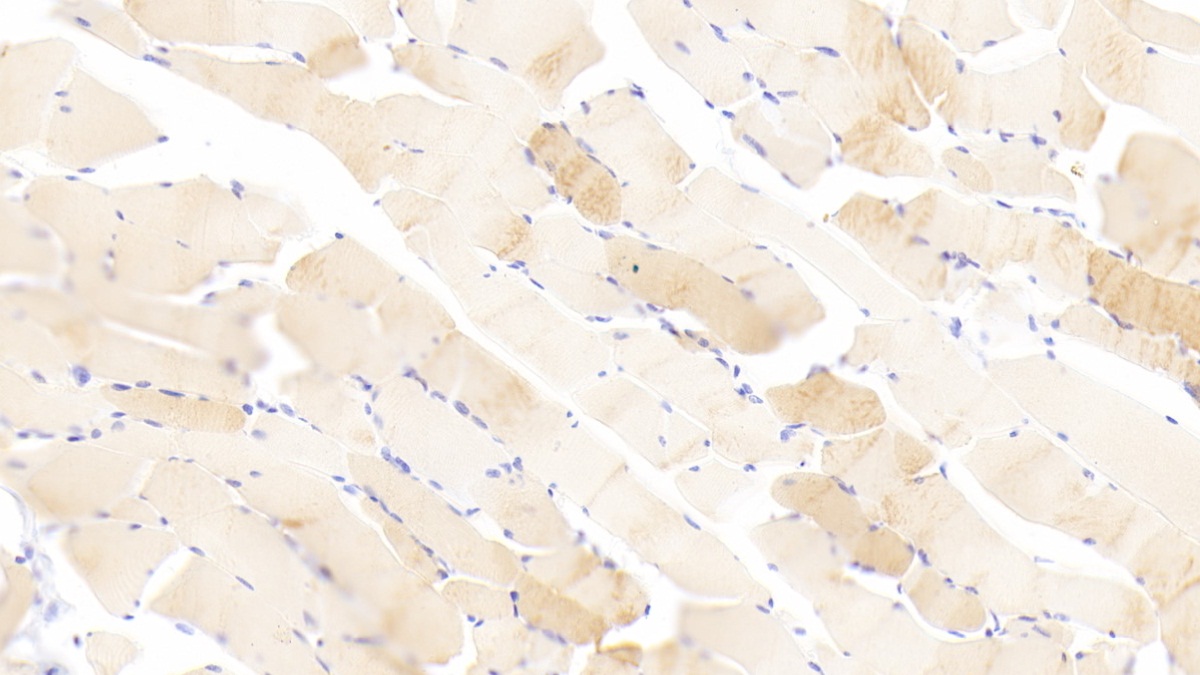 Polyclonal Antibody to Troponin C Type 1, Slow (TNNC1)