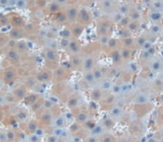 Polyclonal Antibody to Troponin C Type 2, Fast (TNNC2)