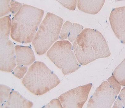 Polyclonal Antibody to Troponin I Type 2, Fast Skeletal (TNNI2)