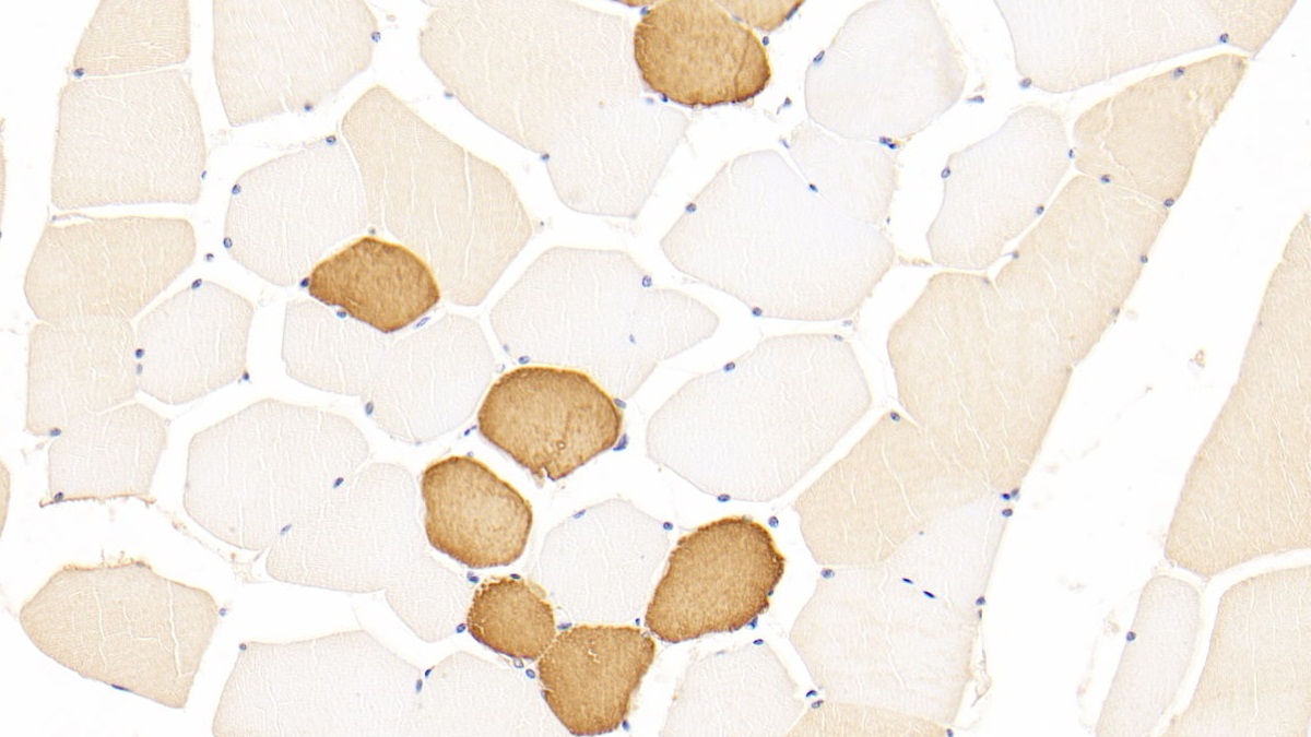 Polyclonal Antibody to Troponin T Type 1, Slow Skeletal (TNNT1)