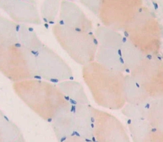 Polyclonal Antibody to Troponin T Type 1, Slow Skeletal (TNNT1)