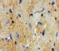 Polyclonal Antibody to Troponin T Type 2, Cardiac (TNNT2)