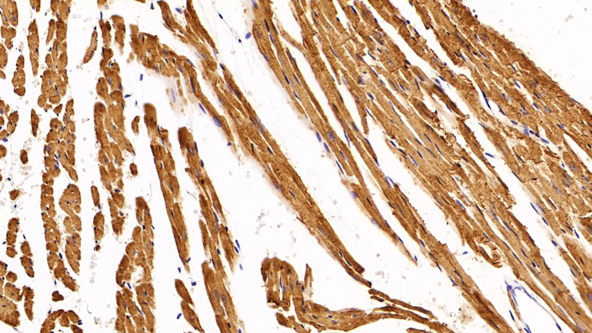 Polyclonal Antibody to Troponin T Type 2, Cardiac (TNNT2)