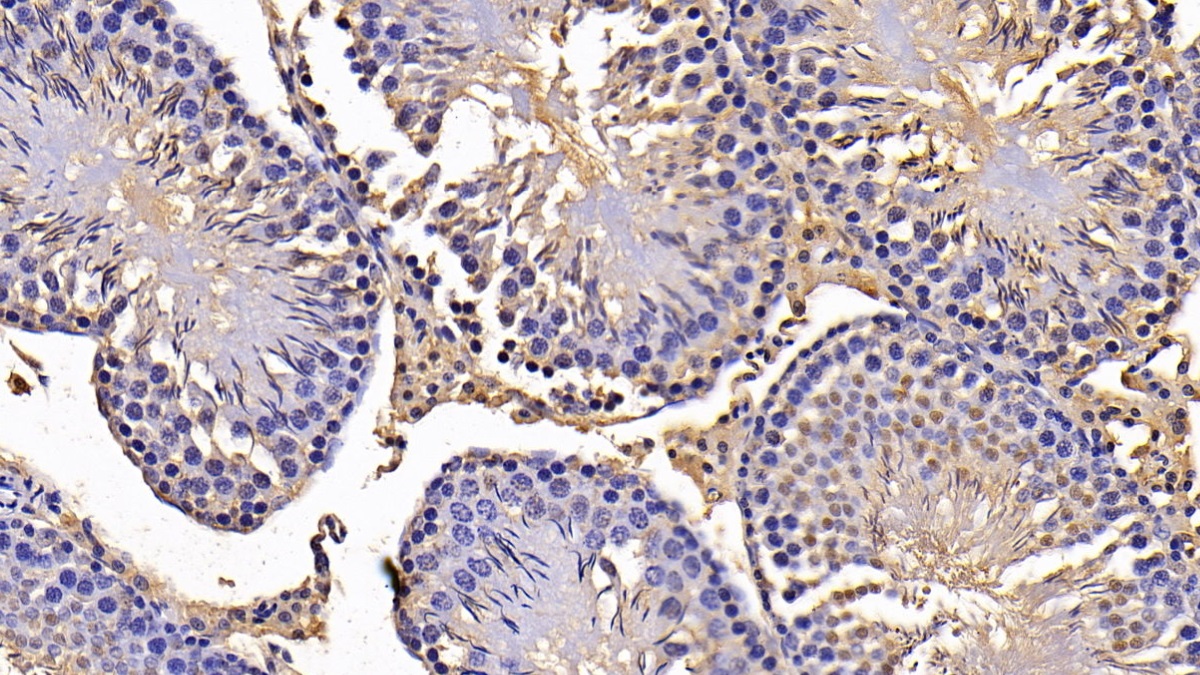 Polyclonal Antibody to Cyclin A1 (CCNA1)