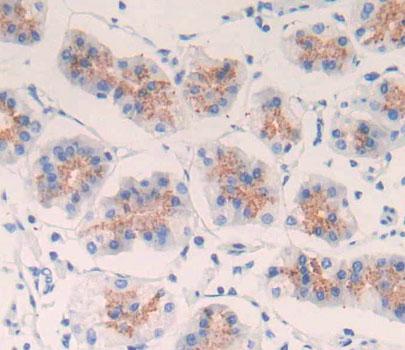 Polyclonal Antibody to Cyclin B (CCNB)