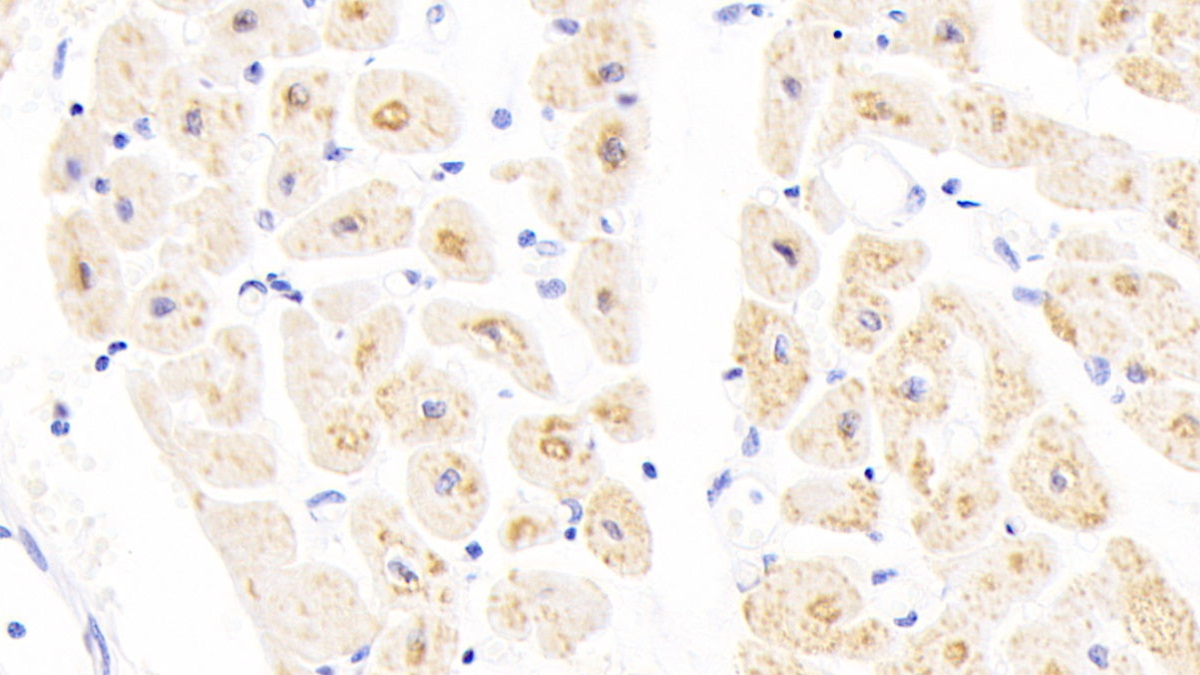 Polyclonal Antibody to Cytochrome C Oxidase Subunit IV Isoform 1 (COX4I1)