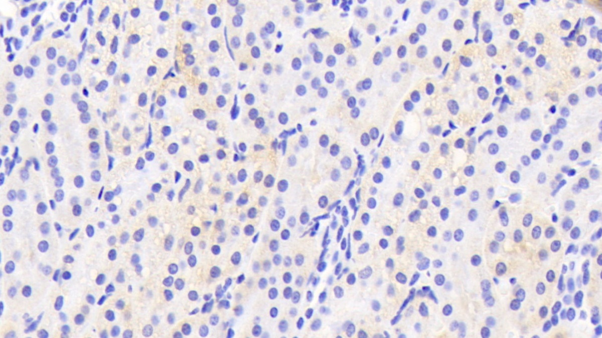 Polyclonal Antibody to Cytochrome P450 2D6 (CYP2D6)