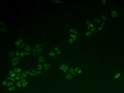 Polyclonal Antibody to Holocytochrome C Synthase (HCCS)