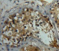 Polyclonal Antibody to Left/Right Determination Factor 2 (LEFTY2)