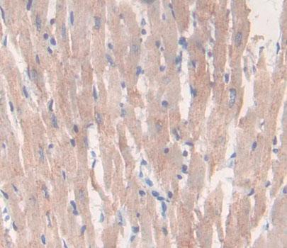 Polyclonal Antibody to Left/Right Determination Factor 2 (LEFTY2)